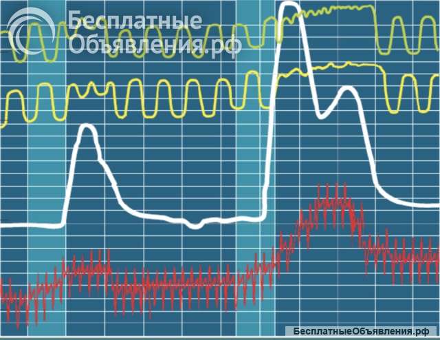 Проверки на полиграфе (детектор лжи)