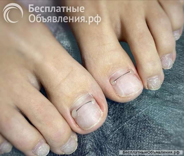 Подолог, педикюр
