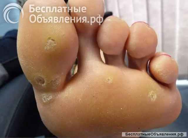 Подолог, педикюр