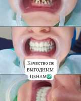 Стоматологические туры в Китай