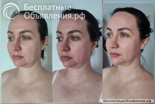 НЕТ шаблонам ДА индивидуальному подходу
