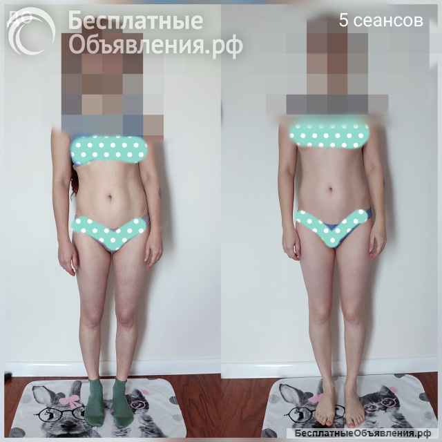 НЕТ шаблонам ДА индивидуальному подходу