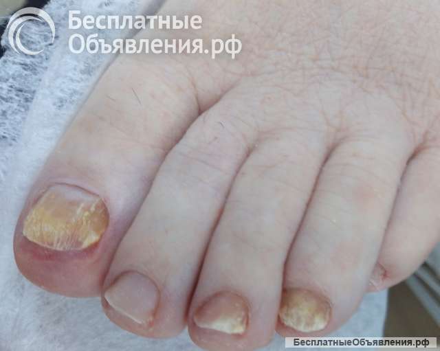 Подолг, вызов на дом