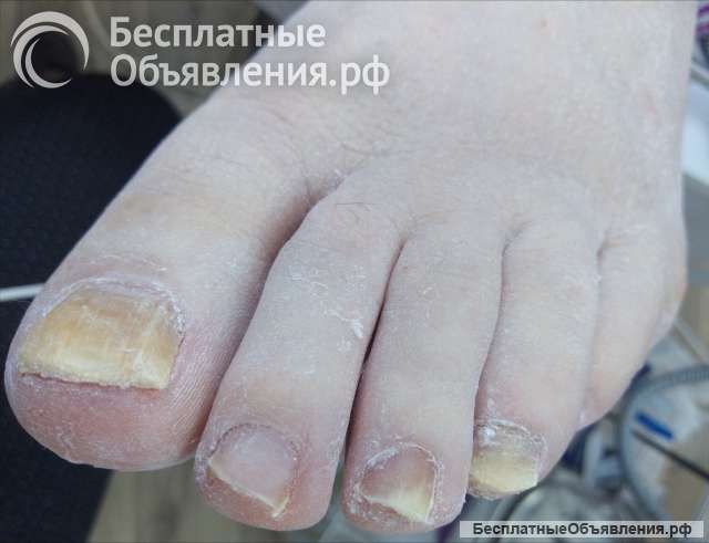 Подолг, вызов на дом