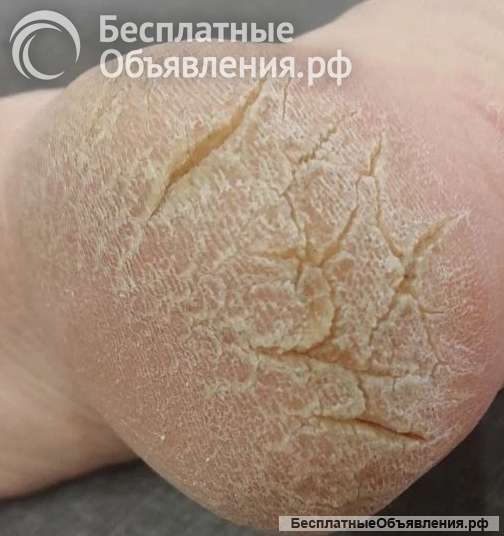Подолг, вызов на дом