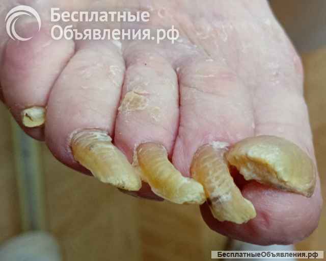 Подолг, вызов на дом