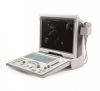 УЗИ сканер Mindray DP 50
