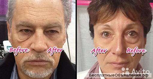 Jeunesse Global Устранение любых проблем на лице за 2 минуты