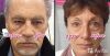 Jeunesse Global Устранение любых проблем на лице за 2 минуты
