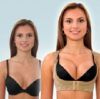 Корректирующий корсет «CHIC SHAPER»
