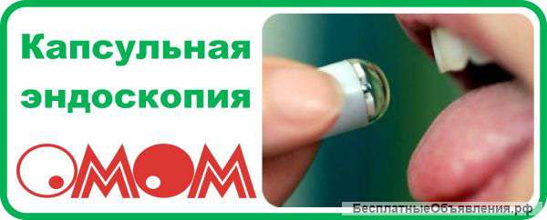 Капсульная эндоскопия (исследование ЖКТ)