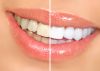 Отбеливание зубов white smile теперь в красноярске
