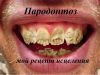 Пародонтоз-полное исцеление