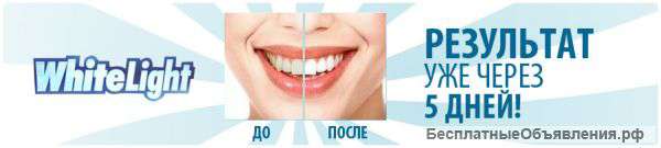 Лазерное отбеливание зубов