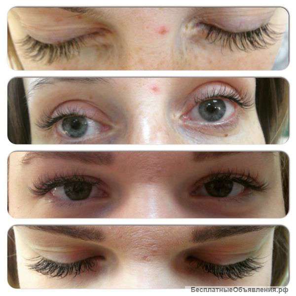 Наращивание ресничек