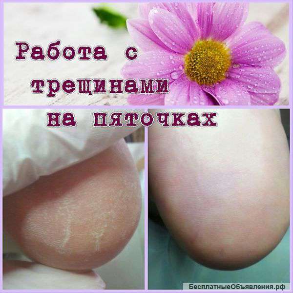 Все виды педикюра
