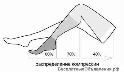 Чулок компрессионный кругловязанный (до бедра) , 2 класс компрессии