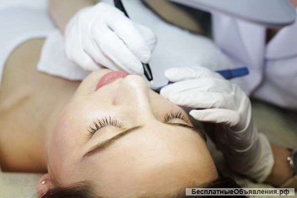 Электроэпиляция