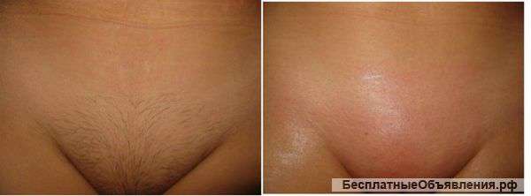 Шугаринг Волгоград Маникюр Шеллак от Призера Международных Чемпионатов