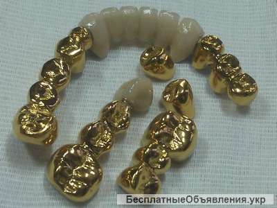 Вакуумные установки для нанесения покрытий "под золото" на зубные протезы из Беларуси