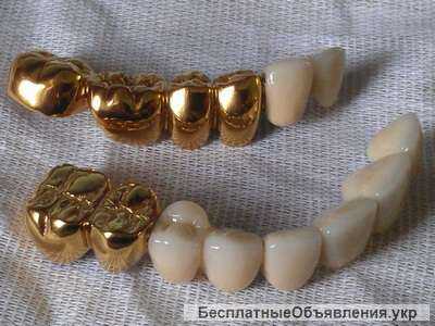 Вакуумные установки для нанесения покрытий "под золото" на зубные протезы из Беларуси