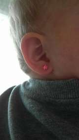 Прокол ушек система 75, пистолет R993 (Стадекс)