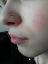 Прокол ушек система 75, пистолет R993 (Стадекс)