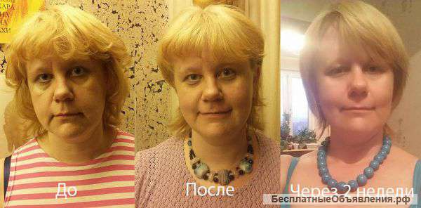 Ладование тела