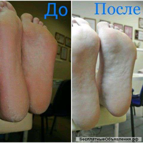Педикюр все виды