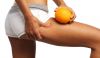 Массаж антицеллюлитный, классический. Обертывания.