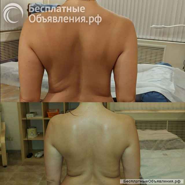 Профессиональный массаж. Депиляция. Частно.