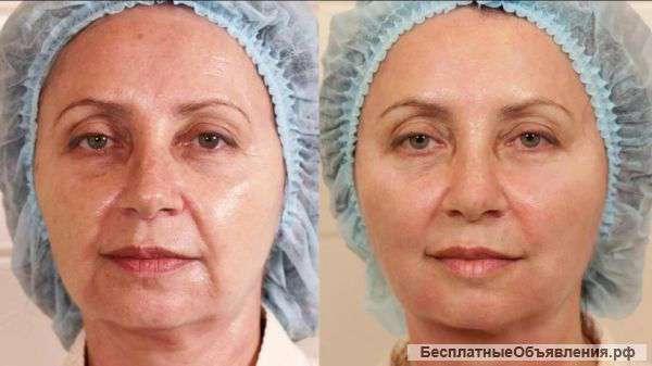 Мезонити 3D